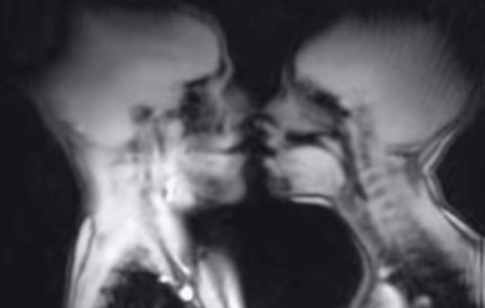 This Is What Sex And Other Things Look Like Inside An Mri Machine Airows